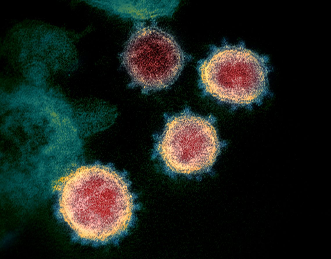 Electron microscope image of the virus that causes COVID-19 (Credit: NIAID-RML/Flickr CC BY 2.0)